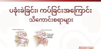 ပခုံးခဲ၊ ပခုံးကပ် ရောဂါ Frozen Shoulder (January 2022)