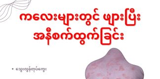 ကလေးများတွင်ဖျားပြီး အနီစက်ထွက်ခြင်း Fever With Rash In Children ( April, 2022 )