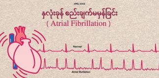 နှလုံးခုန် စည်းချက်မမှန်ခြင်း Atrial Fibrillation ( April, 2022 )