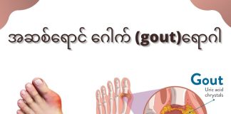 Gout (အဆစ်ရောင်ဂေါက်ရောဂါ) ( May, 2022 )