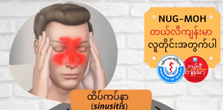 ထိပ်ကပ်နာ Sinusitis ( May, 2022 )