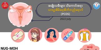 သားဥအိမ်ရေအိတ်တည်ခြင်း PCOS (Polycystic Ovarian Syndrome) ( July, 2022 )