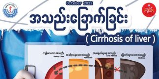 အသည်းခြောက်ခြင်း (သို့) အသည်းကြွပ်ခြင်း Cirrhosis of Liver (October,2022)