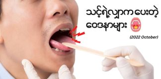 လျှာကပေးတဲ့ ဝေဒနာများ Sore Tongue (October, 2022)