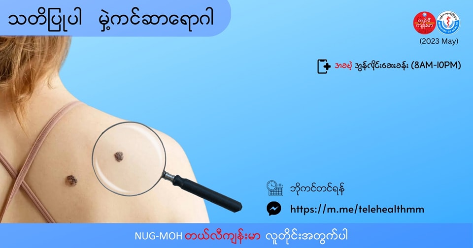 “ဂရုပြုစရာ မှဲ့ကင်ဆာ (Melanoma)”