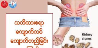 ကျောက်ကပ် ကျောက်တည်ခြင်းအကြောင်း Kidney Stones