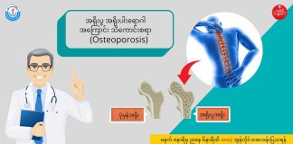 အရိုးပါး/အရိုးပွရောဂါ Osteoporosis ( May, 2022 )