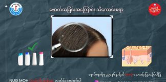 ဗောက်ထခြင်းအကြောင်း သိကောင်းစရာ Dandruff ( May, 2022 )