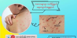 ကလေးများမှာ သတိပြုဖွယ် ရေကျောက်အန္တရာယ် Chickenpox ( May, 2022 )