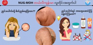 ‘ညှင်း’ အကြောင်းသိကောင်းစရာ PITYRIASIS VERSICOLOR (TINEA VERSICOLOR) ( May, 2022 )