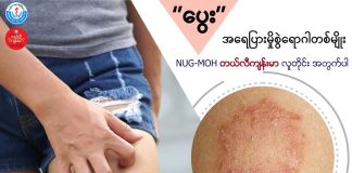 သိကောင်းစရာ ‘ပွေး’ ယားနာ DERMATOPHYTOSIS (TINEA/RINGWORM) ( May, 2022 )