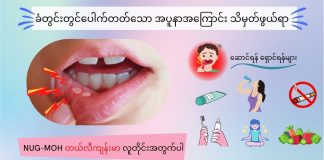 ခံတွင်းမှာပေါက်လေ့ရှိတဲ့ အပူနာအကြောင်း Apthous Ulcer ( May, 2022 )