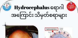 ရေများနေတဲ့ ဦးခေါင်း Hydrocephalus ( June, 2022 )