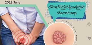 လိင်အင်္ဂါကြွက်နို့ အကြောင်းသိကောင်းစရာ Genital Wart/ Anal Wart( June, 2022 )