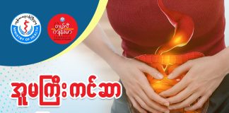 အူမကြီးကင်ဆာ Colorectal Carcinoma (July, 2022)