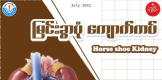 မြင်းခွာပုံ ကျောက်ကပ် Horse Shoe Kidney( July, 2022 )