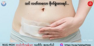 ဗိုက်မှာခွဲစိတ်မှုခံယူထားရင် ဂရုစိုက်ရန်အချက်များ Abdominal Surgery