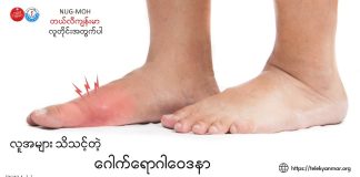 Gout (ဂေါက်)ရောဂါ