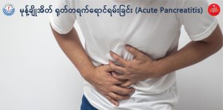မုန့်ချိုအိတ် ရုတ်တရက်ရောင်ရမ်းခြင်း Acute Pancreatitis