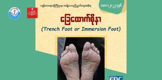 ခြေထောက်စိုနာ Trench Foot or Immersion Foot (Video)