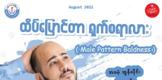 ထိပ်ပြောင်ခြင်း Male Pattern Baldness (August, 2022)