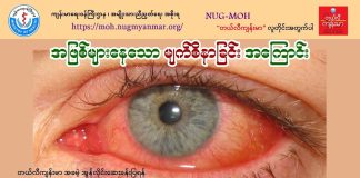 အဖြစ်များနေတဲ့ မျက်စိနာခြင်းအကြောင်း (Video)(October,2023)
