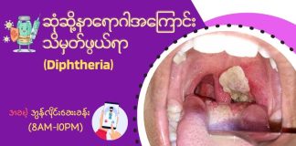 ဆုံဆို့နာရောဂါအကြောင်း သိမှတ်ဖွယ်ရာ (Diphtheria)