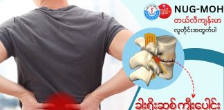ခါးရိုးဆစ် ကျီးပေါင်းတက်ခြင်း (Lumbar Spondylosis)