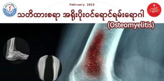 သတိထားစရာ အရိုးပိုးဝင်ရောင်ရမ်းရောဂါ (Osteomyelitis)