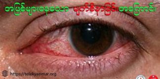 အဖြစ်များနေသော မျက်စိနာခြင်း Adenoviral Conjunctivitis